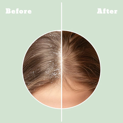 RootRevive Rosemary Cleanse
